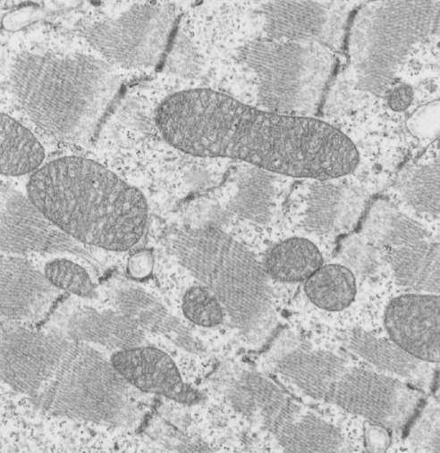 mitochondria.jpg